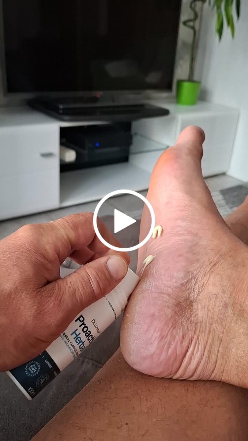 Customer video review of Proactive Herbal+ Speciális Gyógynövény Krém Izmokra, Ízületekre, Talpi Bőnyére