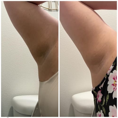 Customer photo review of Alpha-Arbutin + Vitamin C Brightening Bar