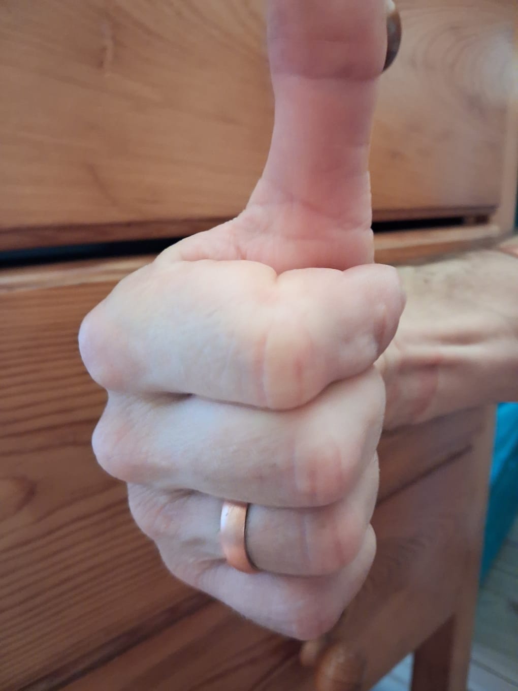 Customer photo review of Bracelet, anneau en cuivre de magnétothérapie avec aimants