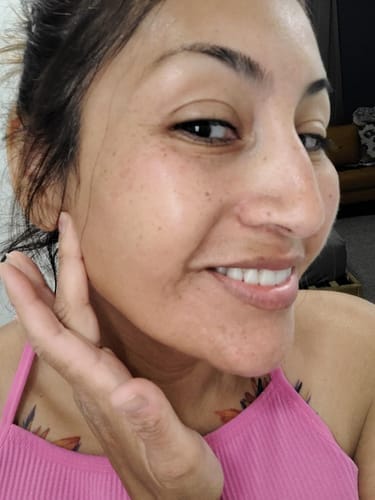 Customer photo review of Alpha-Arbutin + Vitamin C Brightening Bar