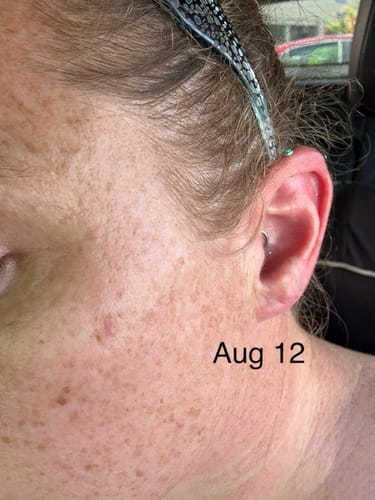 Customer photo review of Alpha-Arbutin + Vitamin C Brightening Bar