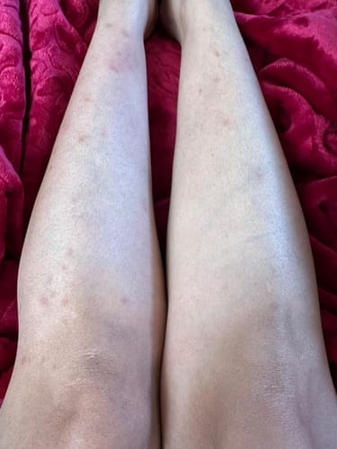 Customer photo review of Alpha-Arbutin + Vitamin C Brightening Bar