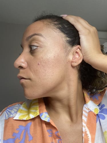 Customer photo review of Alpha-Arbutin + Vitamin C Brightening Bar