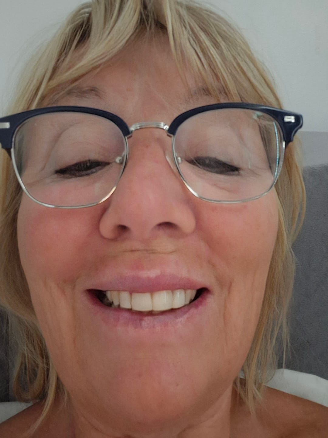 Customer photo review of Essix Retainers