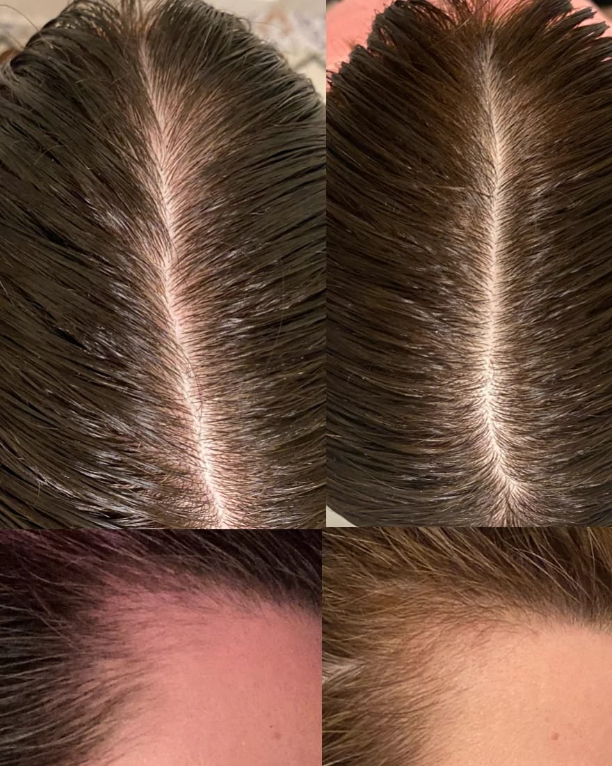Customer photo review of Lovera naiste juuste hõrenemise vastane seerum