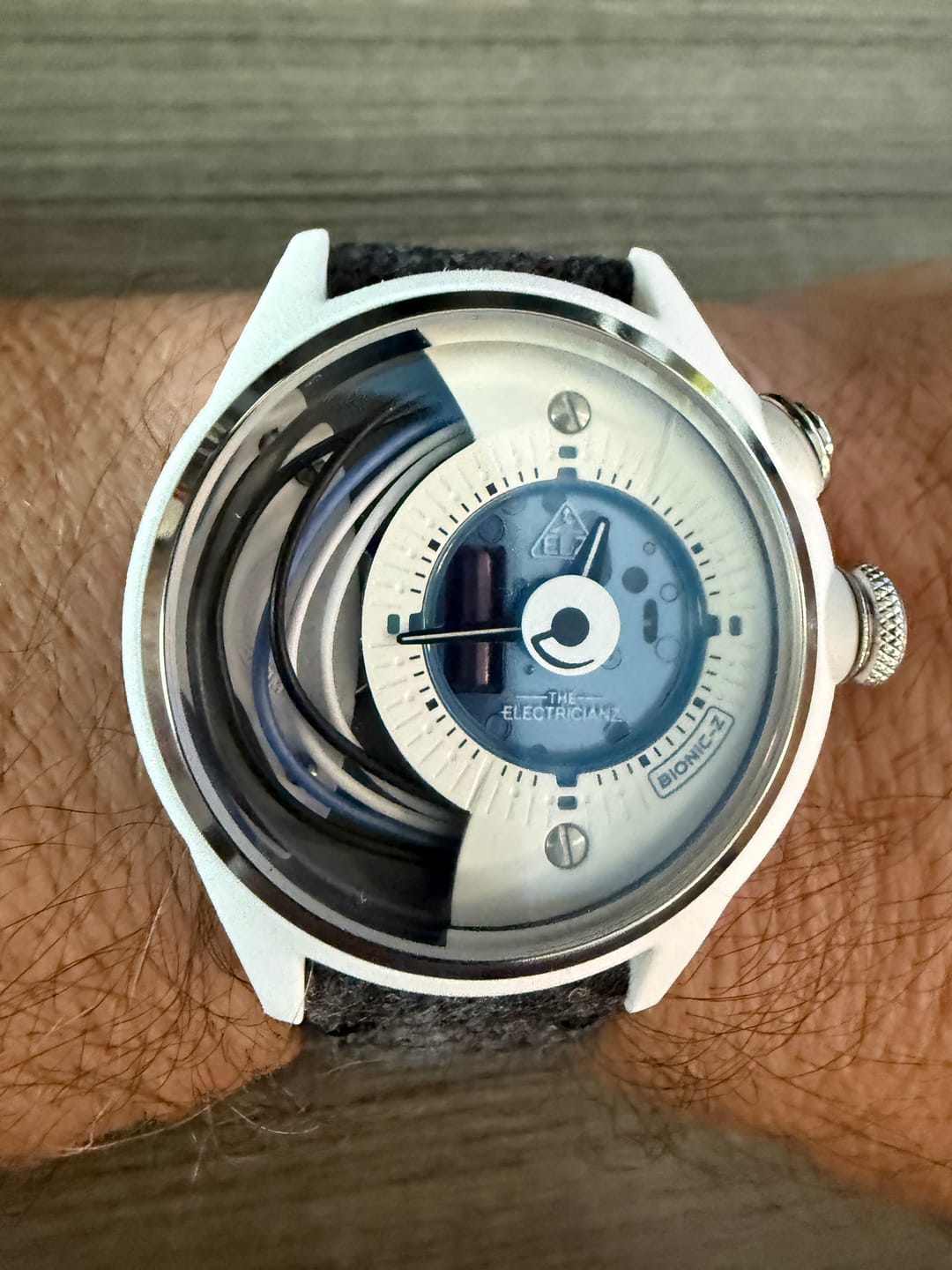 Customer photo review of The Bionic Couture Edition — Limited to 30 pieces