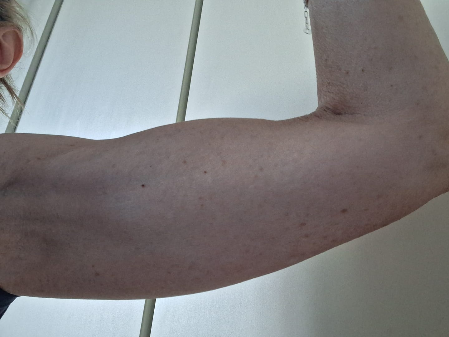 Customer photo review of Crema rassodante braccia ed interno coscia