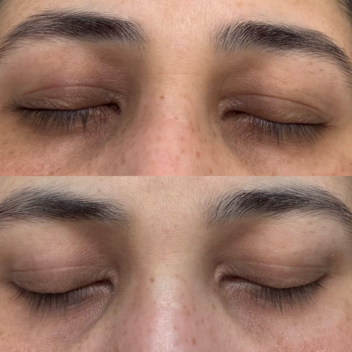 Customer photo review of NEW & IMPROVED LASH SERUM