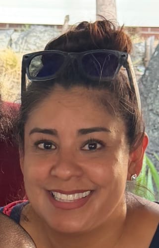Reviewer showing their clear, glowing skin after using the Micro Infusion System treatment.