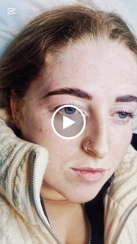 Customer photo review of Brow Care - Purify - 150ml