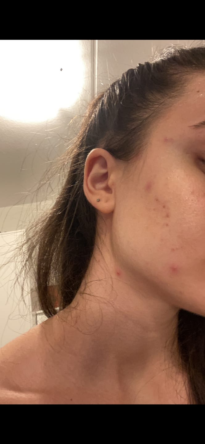 Customer photo review of Sleek Skin Serum 30ml