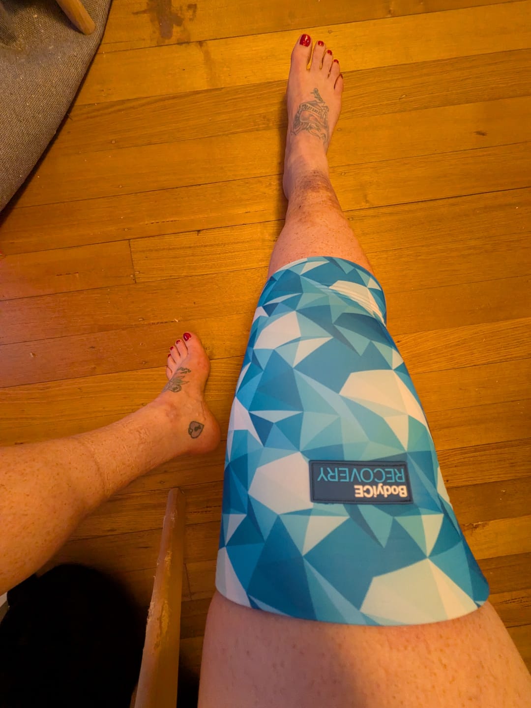 Customer photo review of Large Hot & Cold Compression Gel Sleeve
