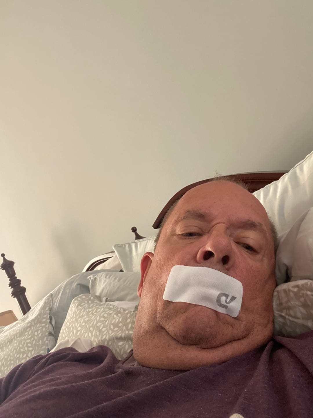 Customer photo review of Dream Mouth Tape