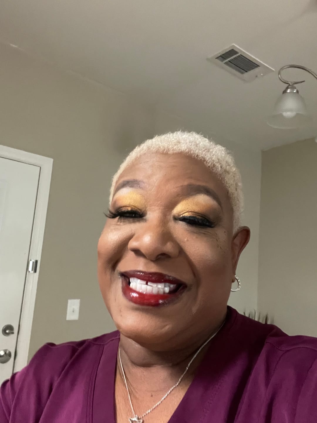 Customer photo review of Satin Oasis: Tumeric, Kojic Acid & Lemon (Sensitive Formula)