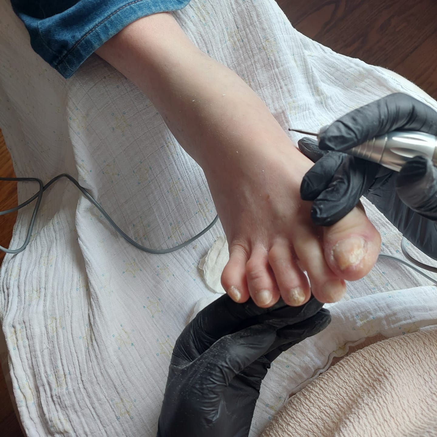 Customer photo review of ReviveNail Pleisters | Tegen Kalk- En Schimmelnagels