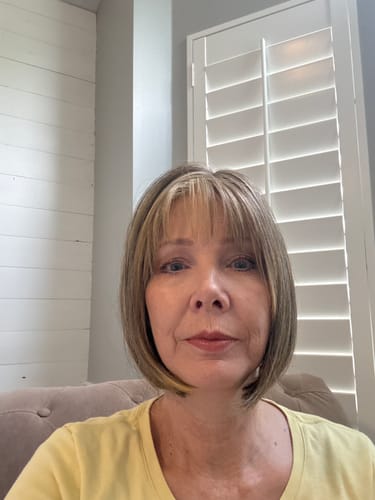 Customer showing hydrated skin after 8 weeks of using Koriderm Time Reverse Cream.