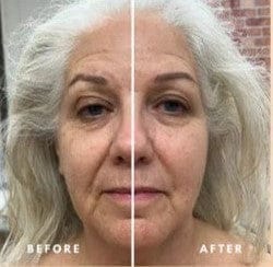 Customer photo review of Nuvetra Lymphatic Face Brush