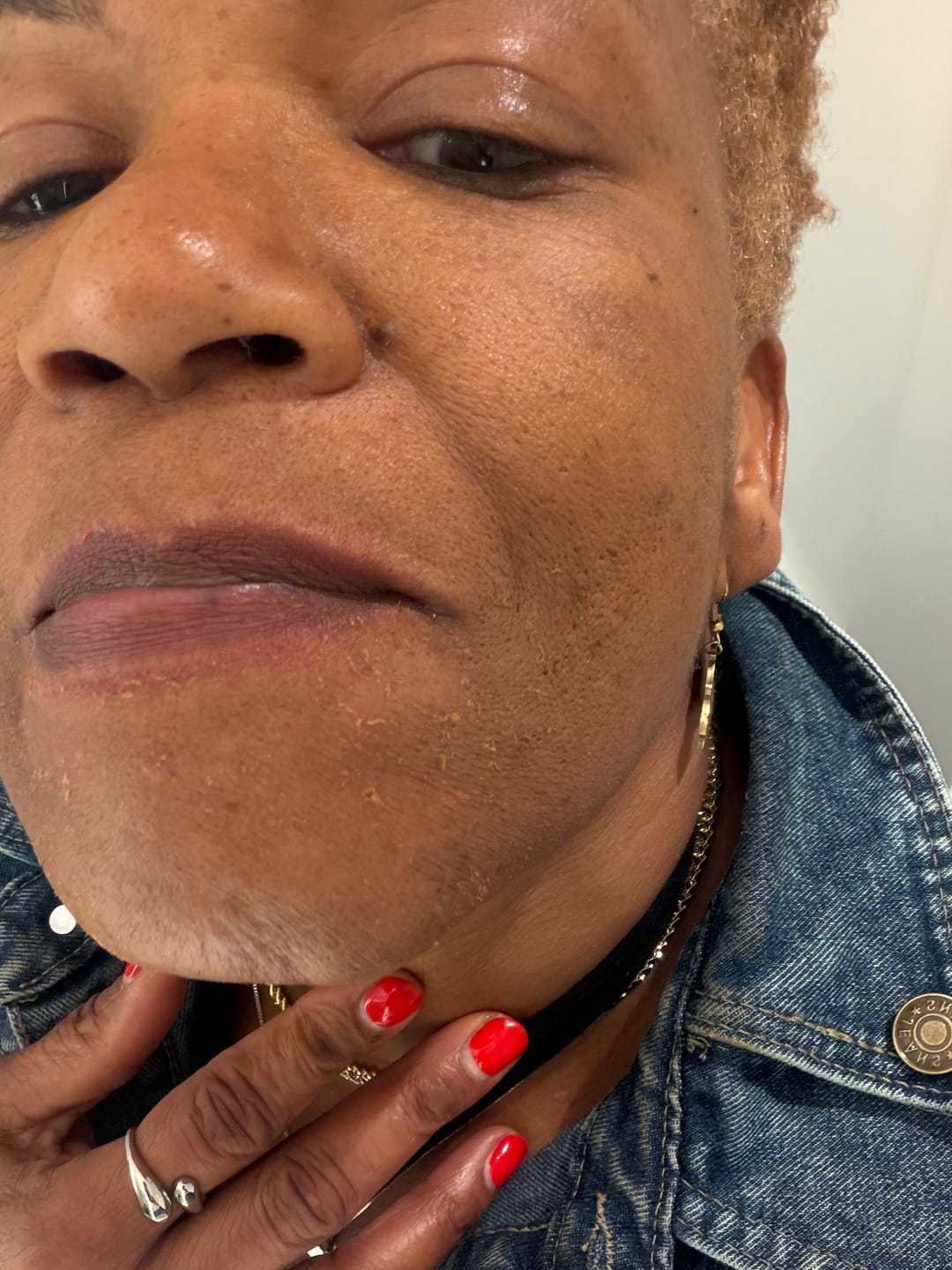 Customer photo review of Melanin Skin Bundle
