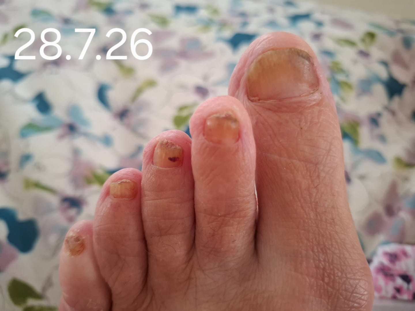 Customer photo review of Fungal Freedom