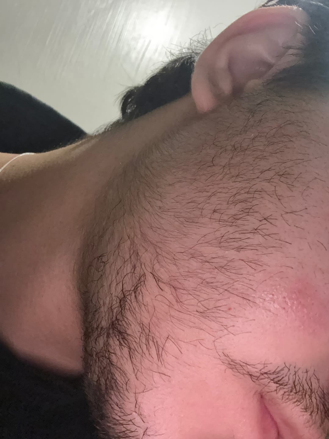 Customer photo review of Kit Barba Real | 2 Minoxidil al 20% +Biotina + Derma | El kit más Completo para crecimiento de Barba