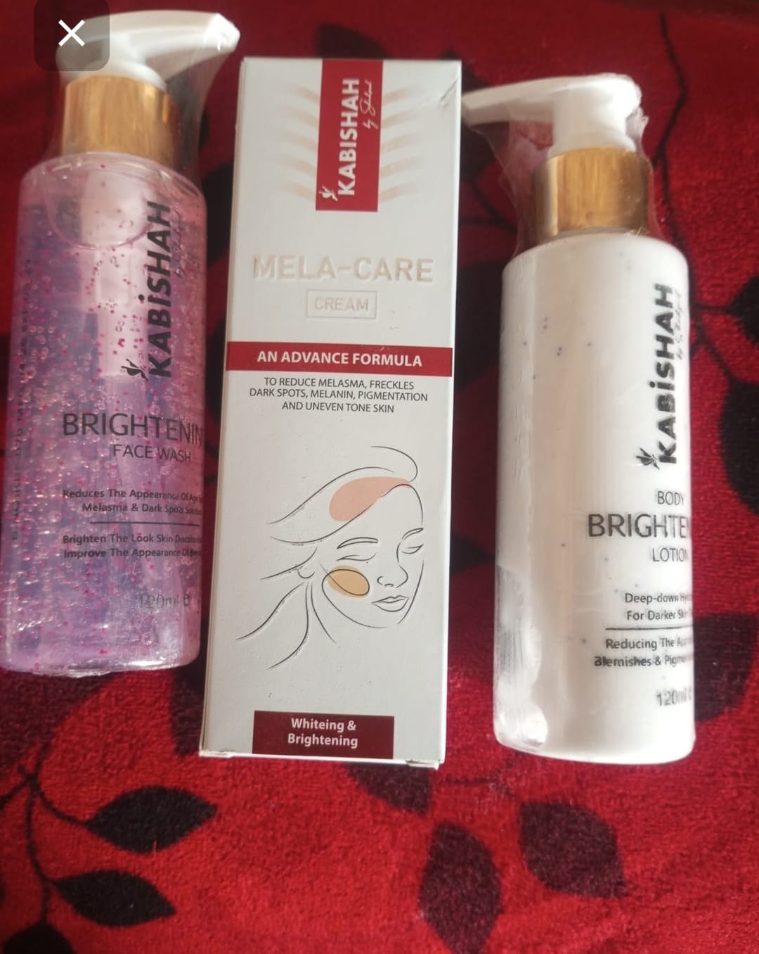 Customer photo review of Complete Fairness Radiance Bundle: Whitening Trio