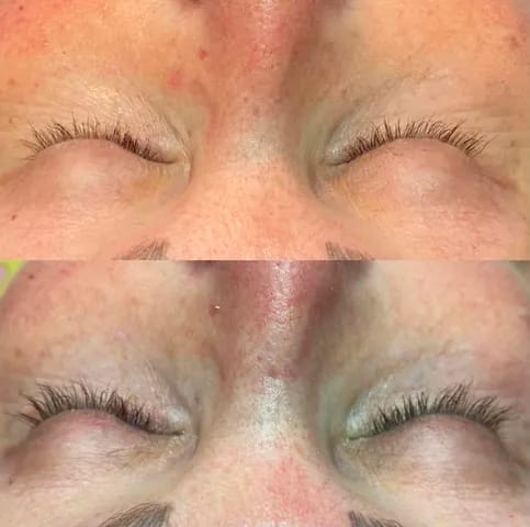 Customer photo review of Purely Lashes Lash Growth Serum