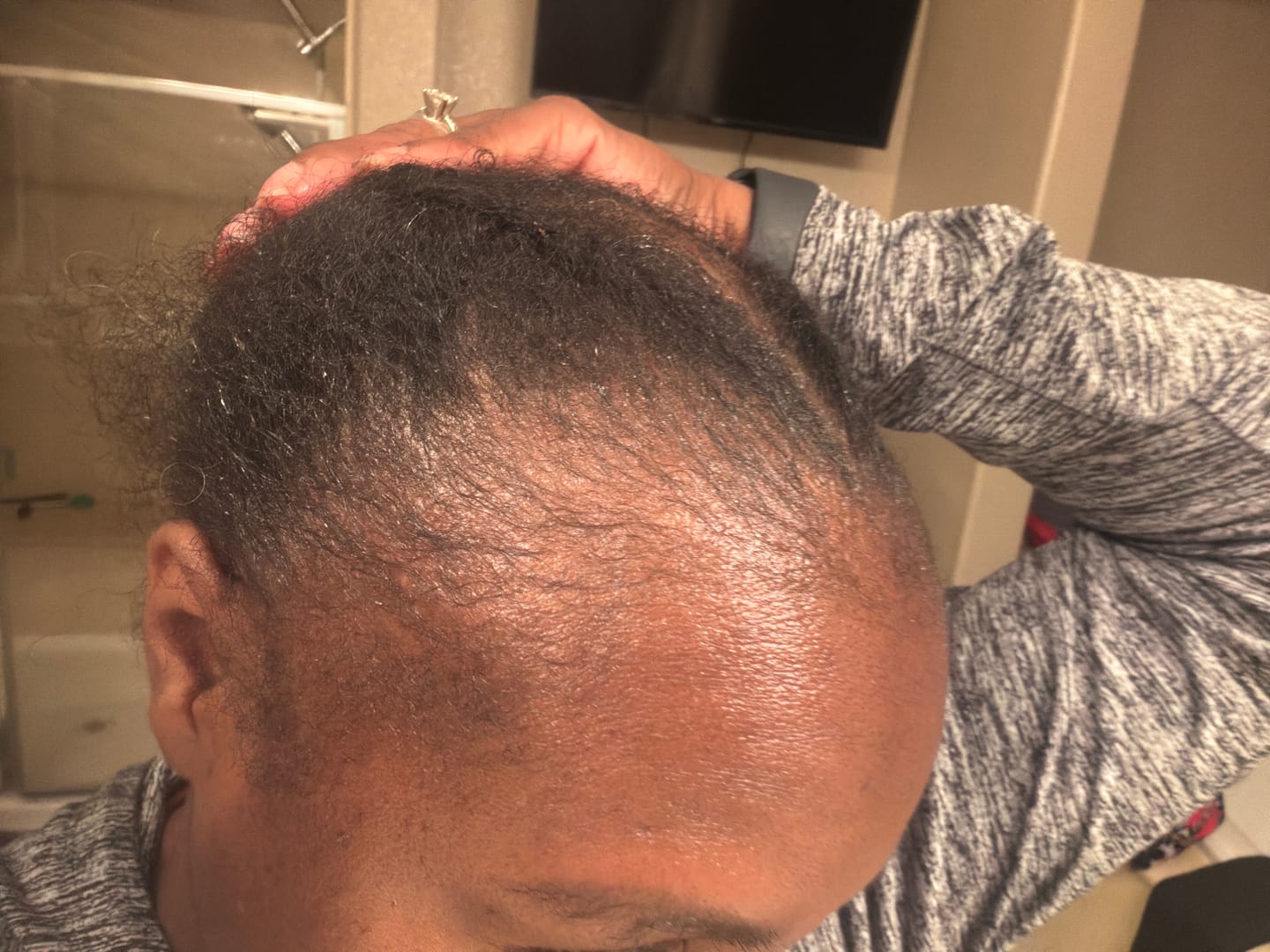 Customer photo review of Gro & Glow Liquid Vitamins - 2 Month Supply!
