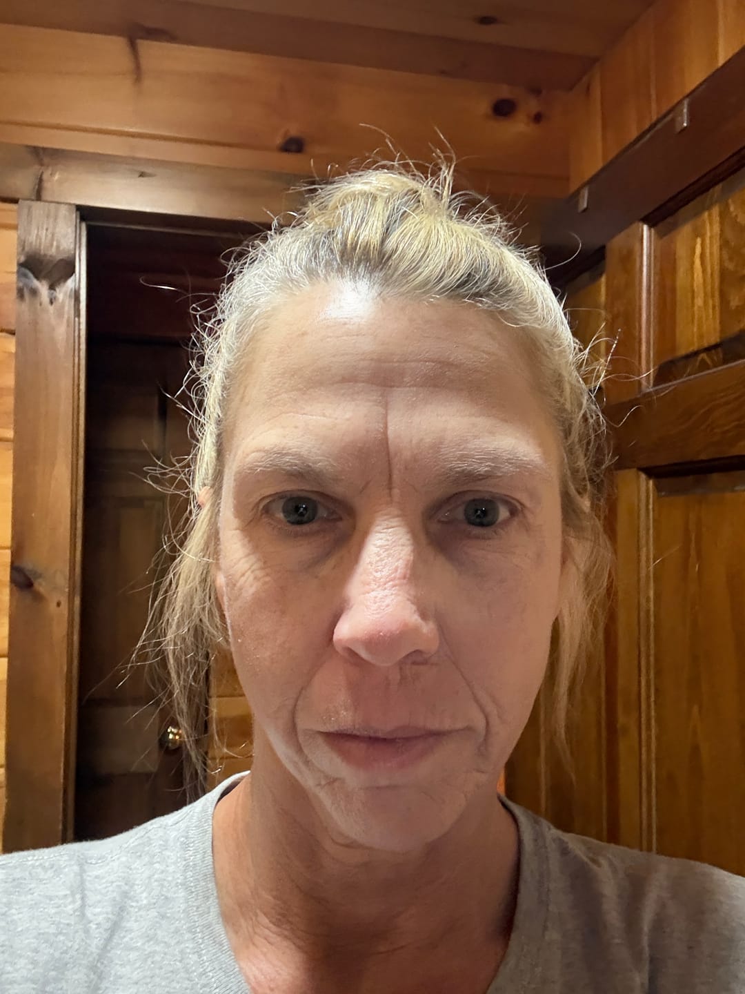Customer photo review of Collagen Mask