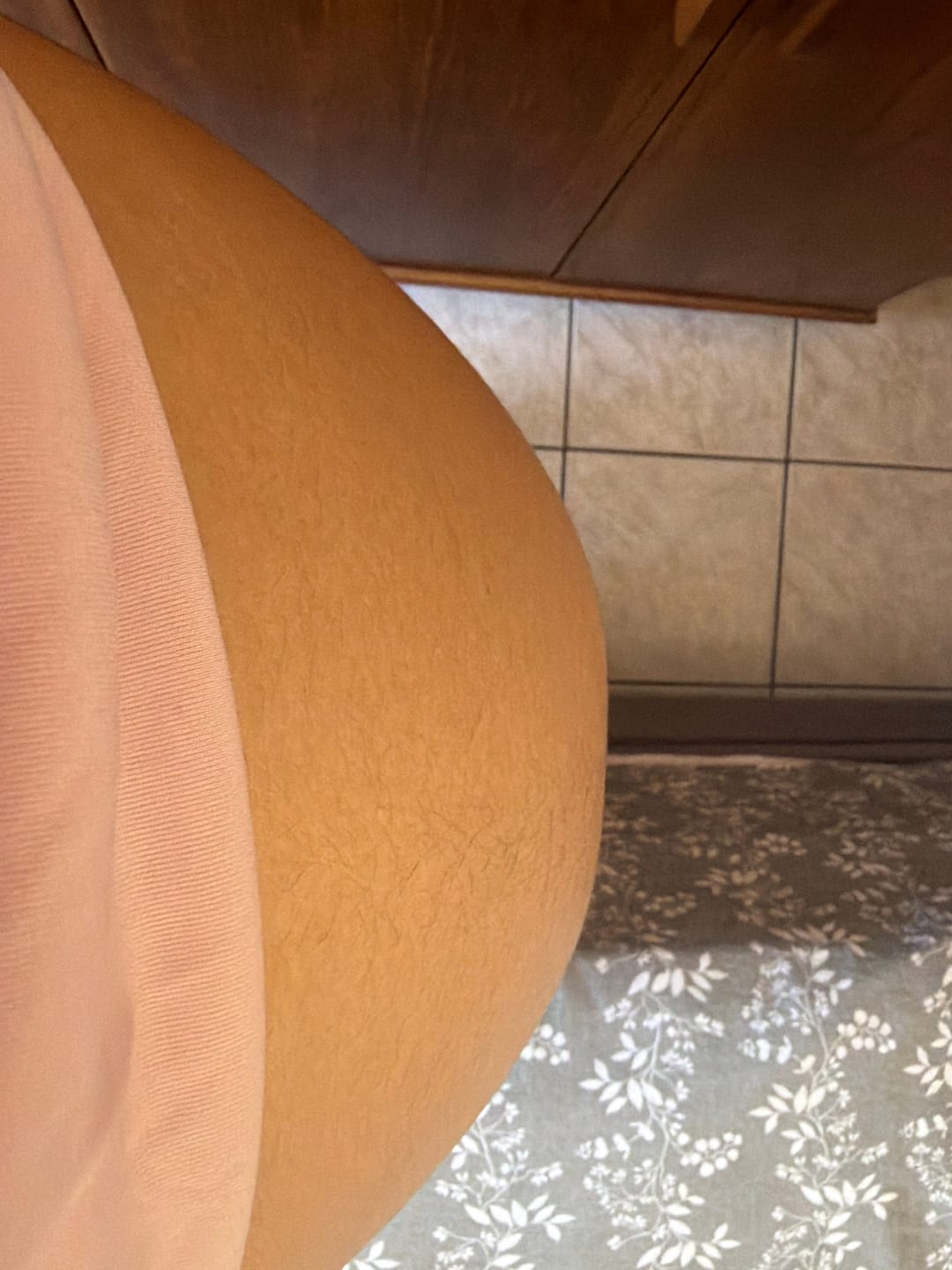 Customer photo review of Creme Antiestrias Regenerador Dérmico