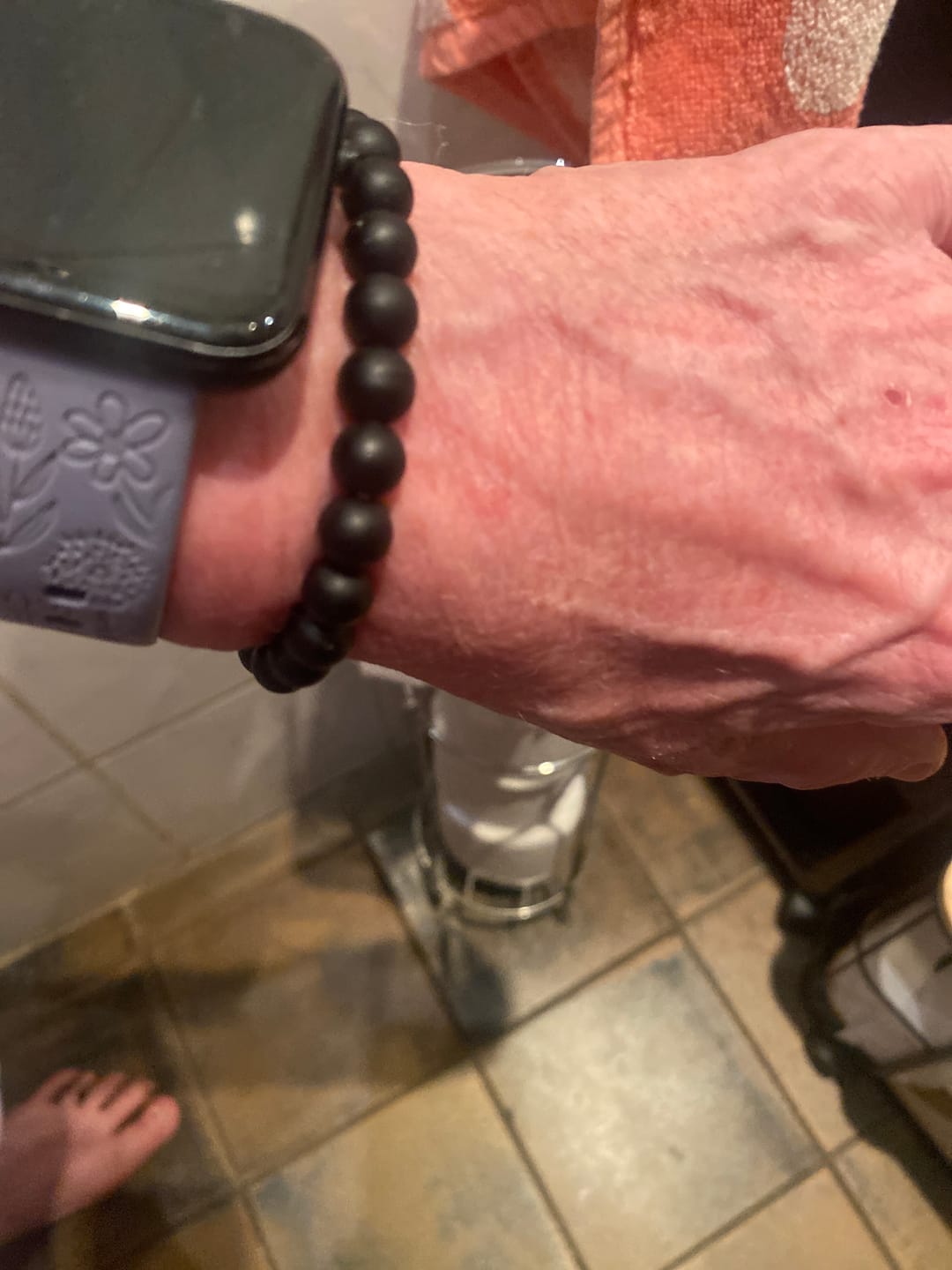 Customer photo review of Medische Waarschuwingsarmband