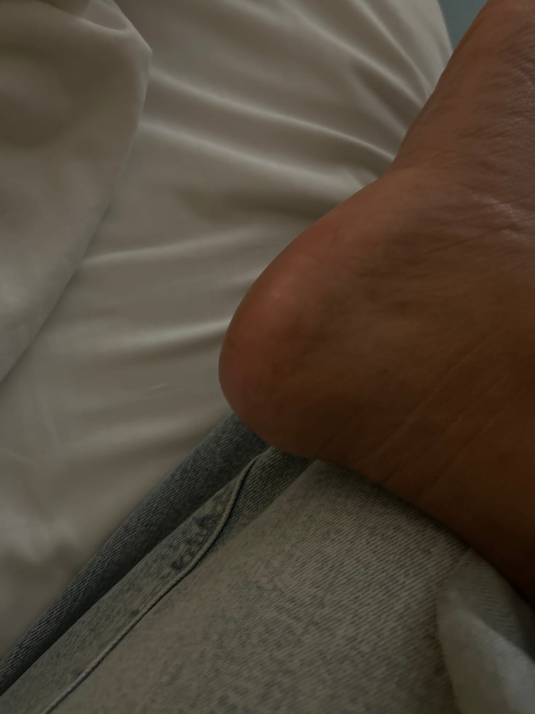 Customer photo review of Foot Balm