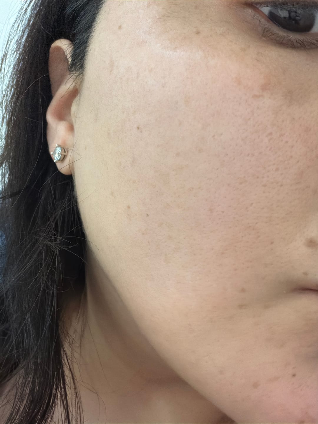 Customer photo review of Sérum Facial Rellenador Energizante
