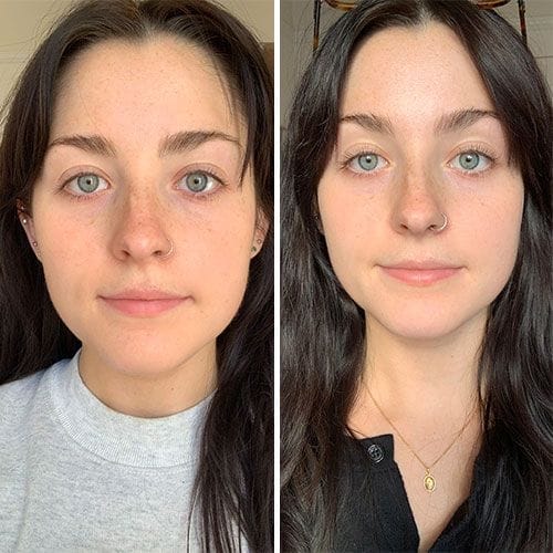 Customer photo review of Nuvetra Lymphatic Face Brush