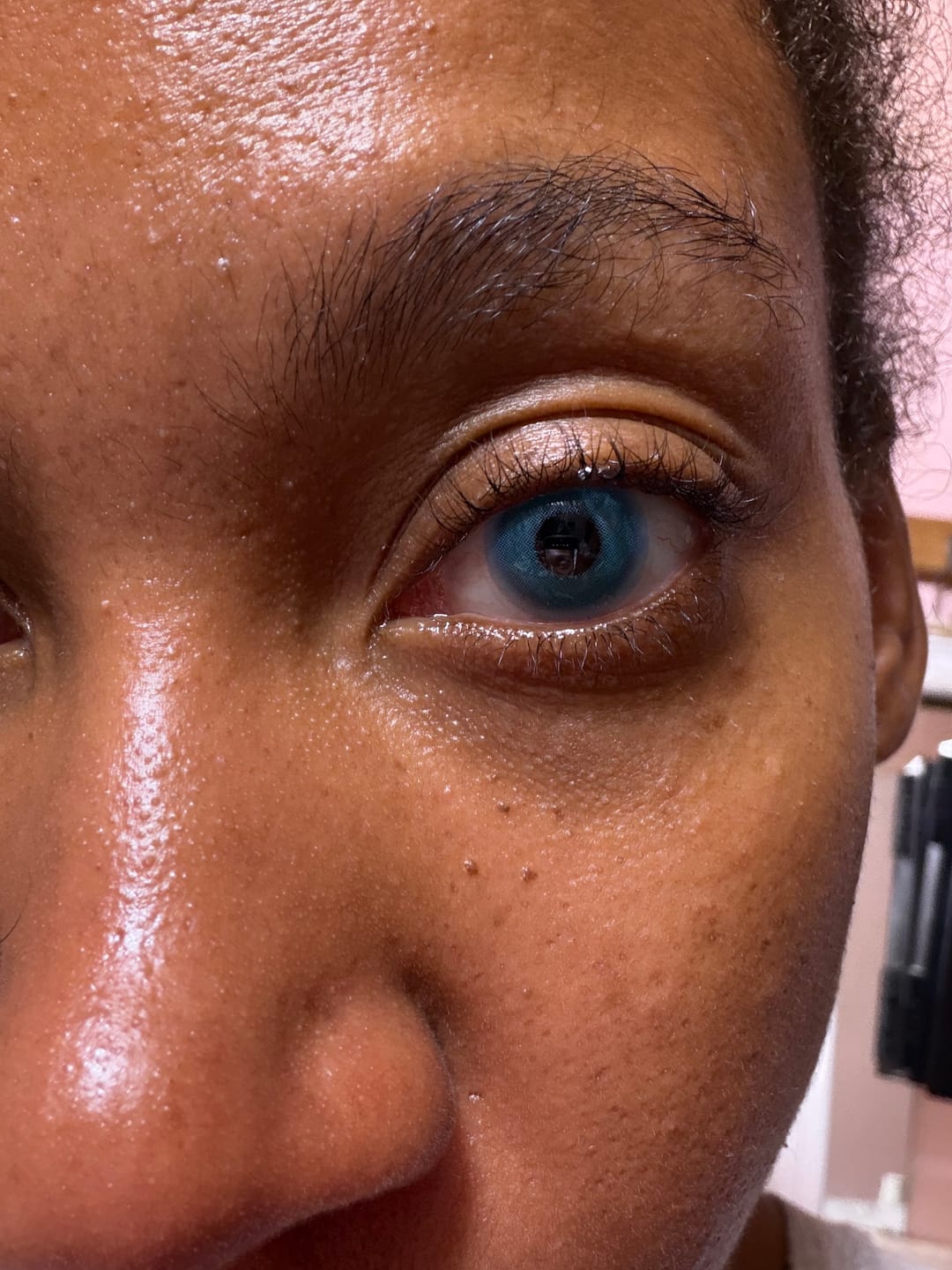 Customer photo review of Pixie Blue Prescription Coloured Contact Lenses