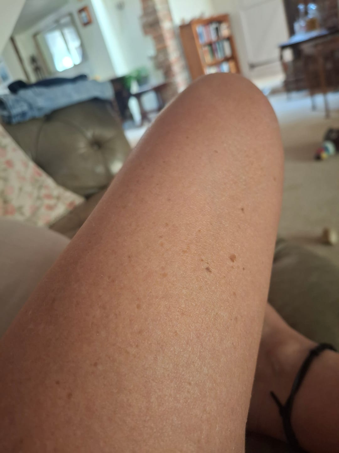 Customer photo review of Body For Us Anti-Cellulite Massage Oil