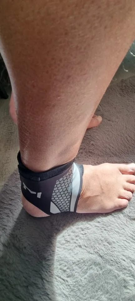 Customer photo review of Restora Plantar Fasciitis Relief Wrap