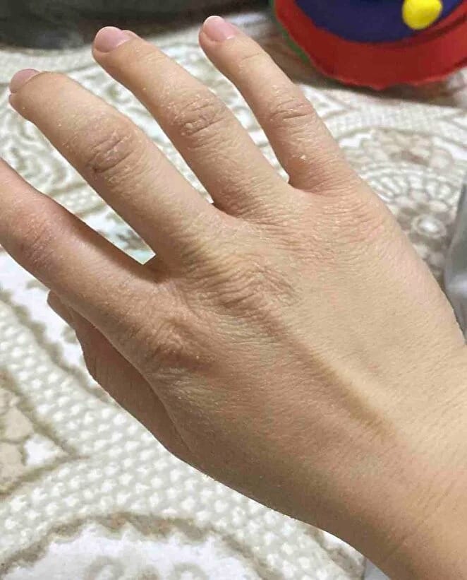 Customer photo review of RBY Botanik Cilt Balmı Yatıştırıcı Bakım Kremi 50 ml