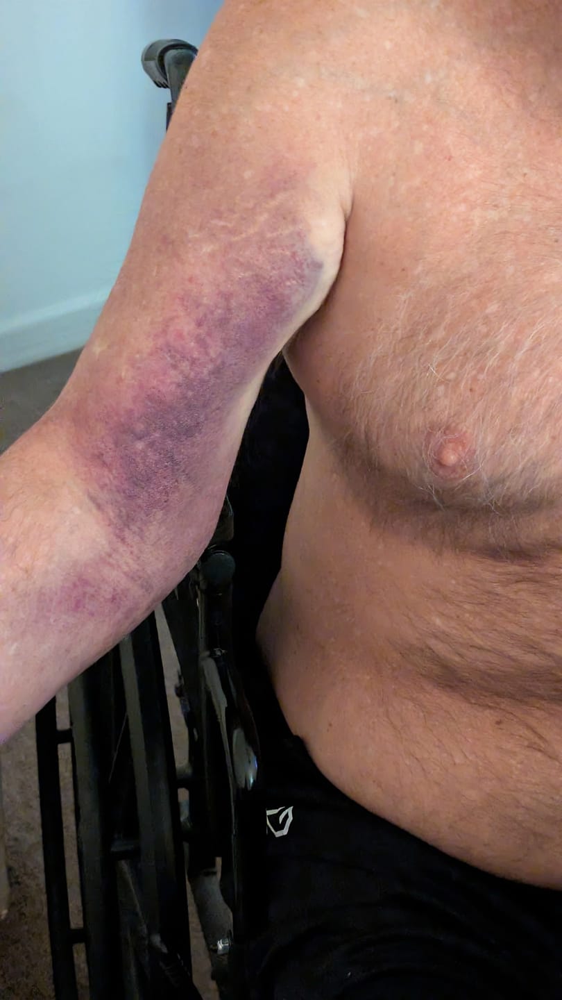 Customer photo review of A.LEAF CBD Comfort Roll-On – 800mg THC-Free | Fast Acting