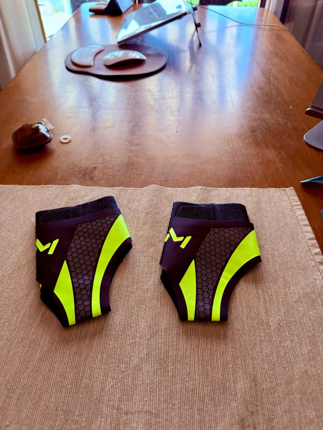 Customer photo review of Restora Plantar Fasciitis Relief Wrap