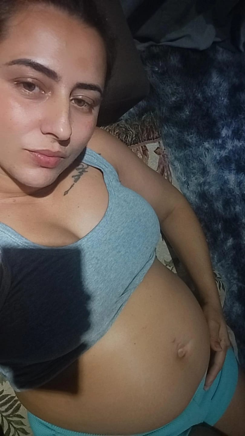 Customer photo review of Creme Antiestrias Regenerador Dérmico