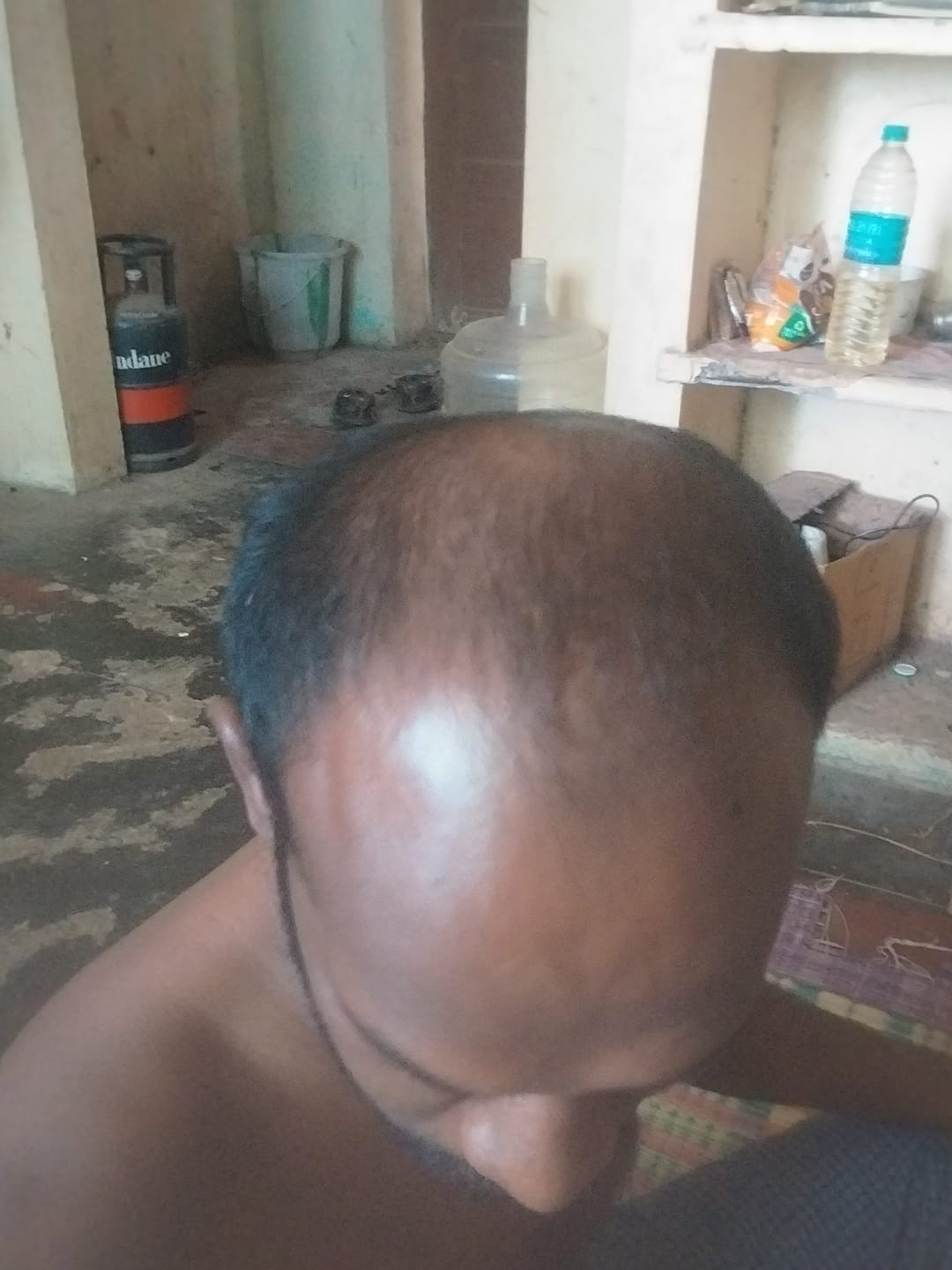 Customer photo review of Advance Hair Growth Serum 2.0 (30ml)