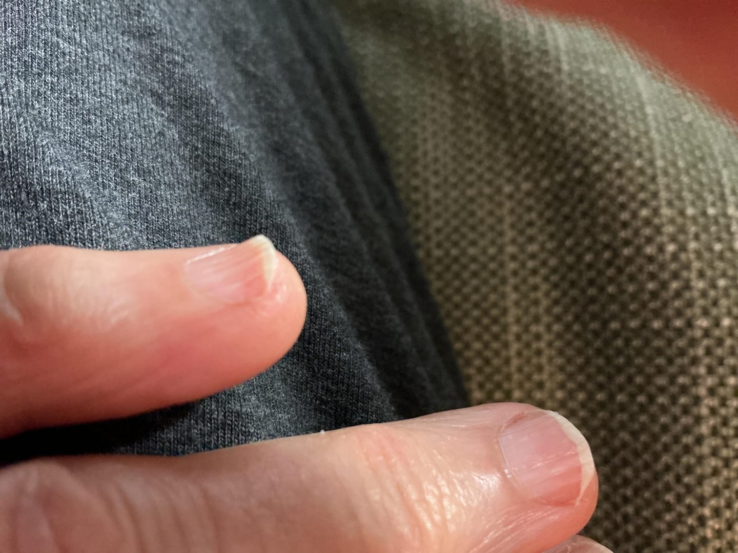 Customer photo review of DermaNail® Nail Conditioner 1 oz