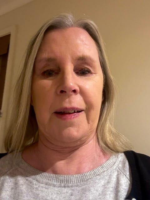 Customer photo review of Sea Cucumber Collagen Brightening Balance Serum