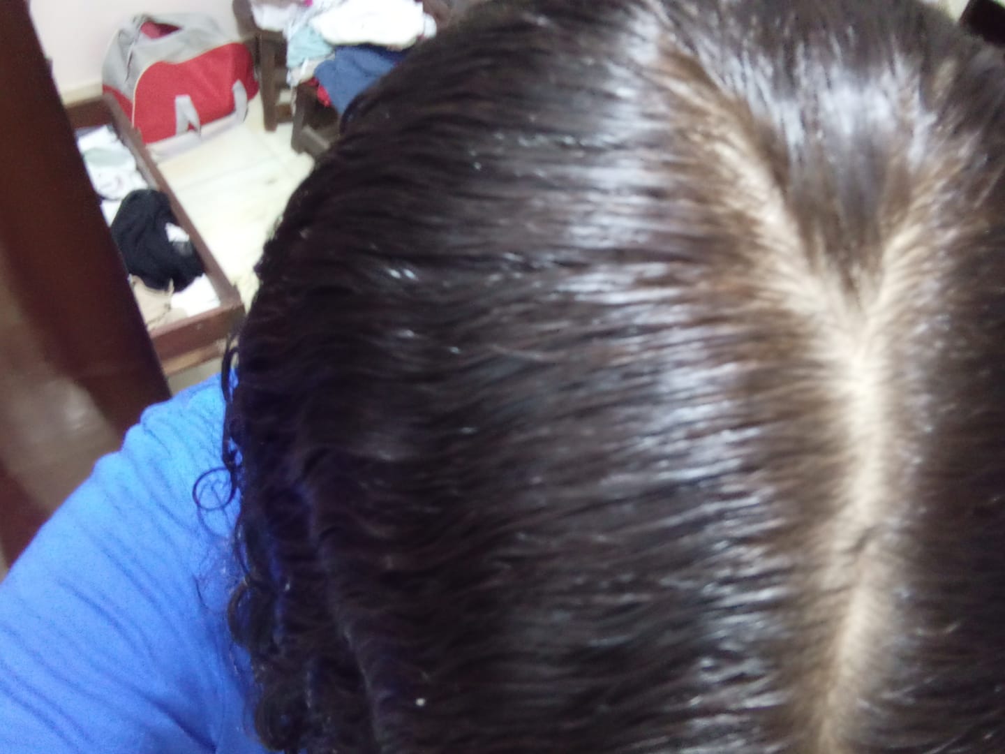 Customer photo review of Hydra Nourish Mega Set