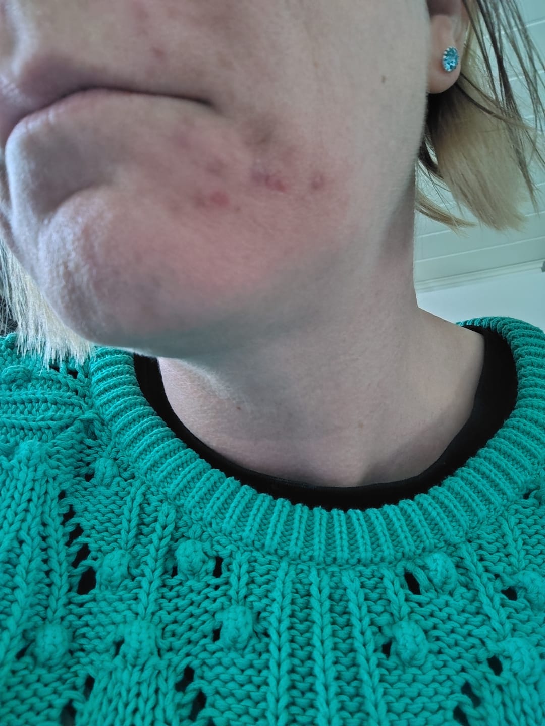 Customer photo review of Silky Sage Talivoide
