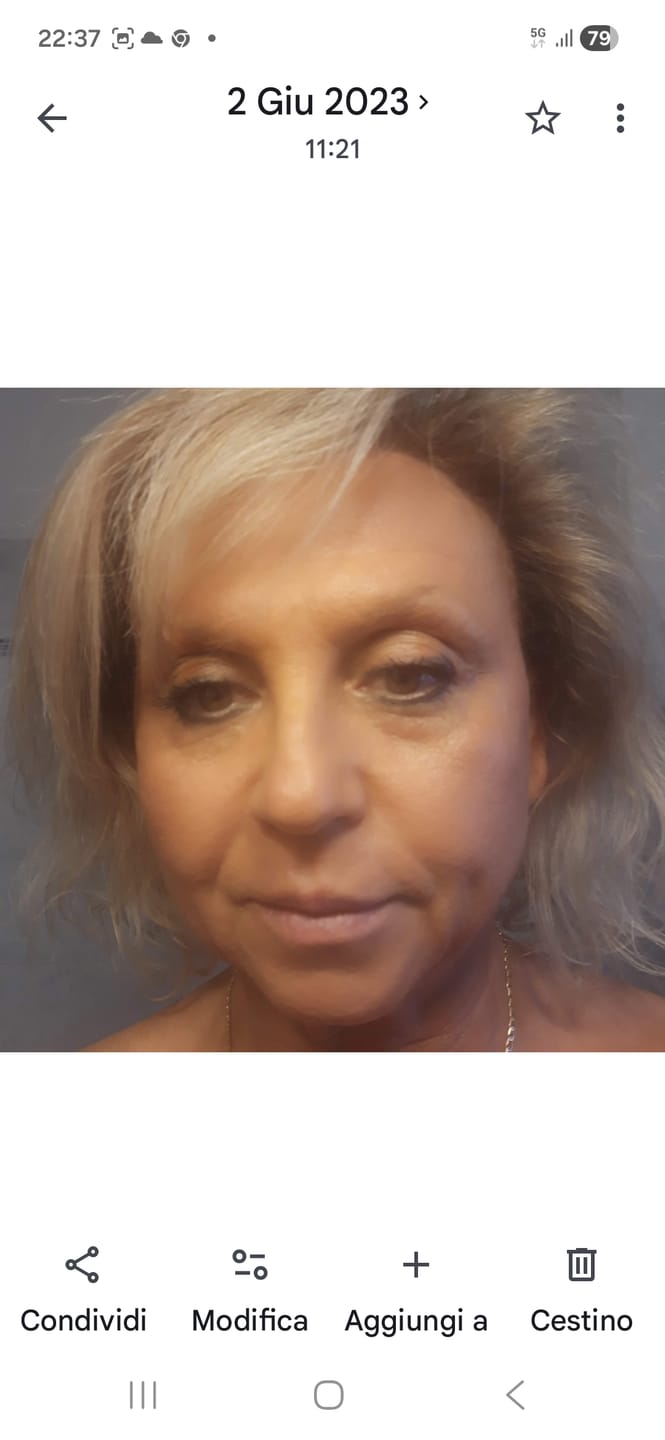 Customer photo review of Biochroma - Crema Collo Liftante & Rassodante