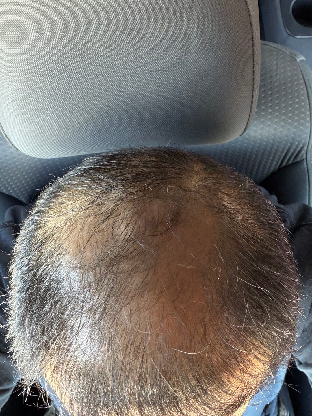 Customer photo review of Spartan™ Root Activator Shampoo 3 Bottles(sc)