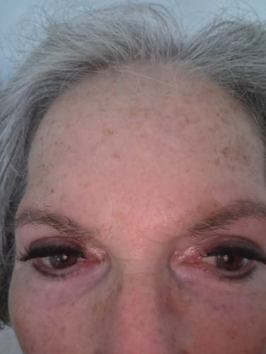 Kundenfoto mit den natürlich wirkenden Wimpernsegmente des PICK ME, BABY Applikators am Wimpernkranz einer Person.