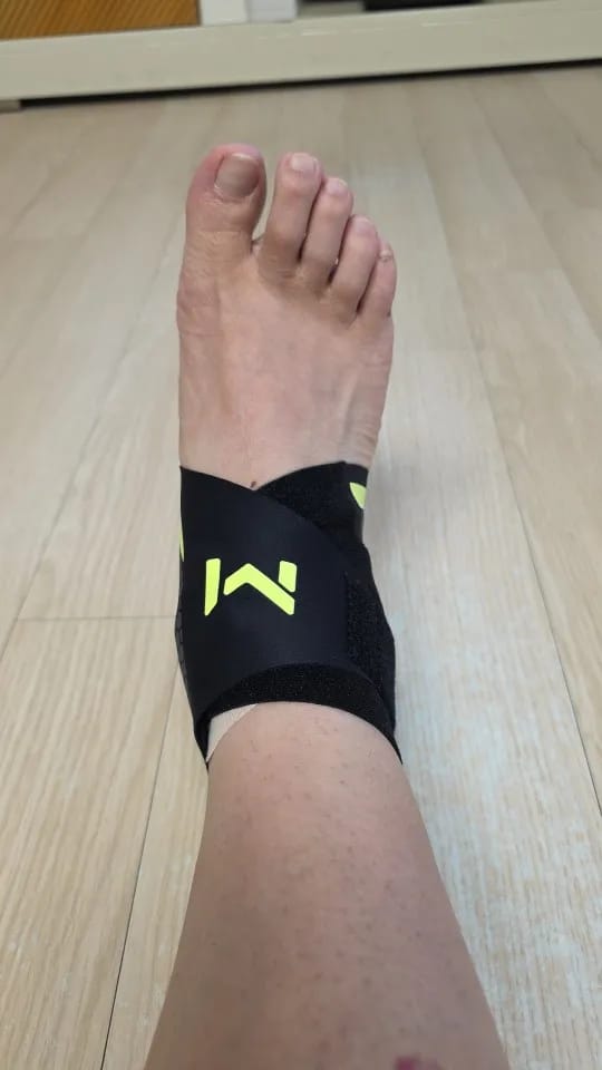 Customer photo review of Restora Plantar Fasciitis Relief Wrap