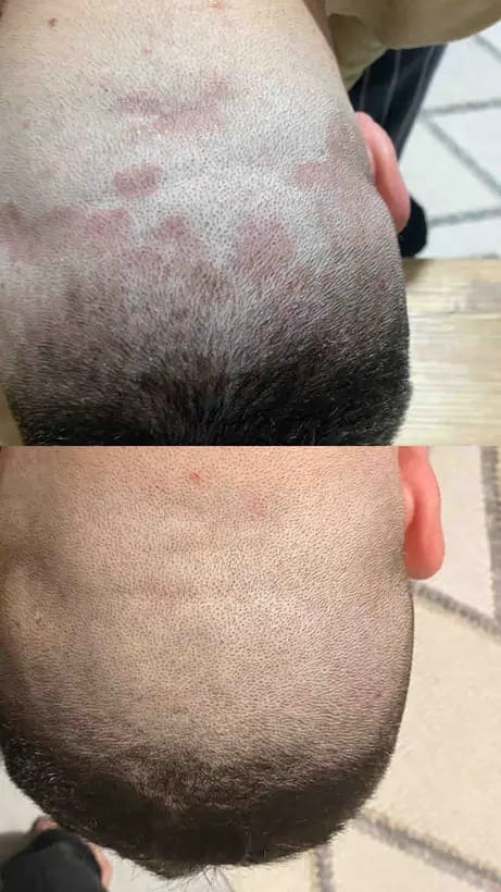 Customer photo review of RBY Botanik Cilt Balmı Yatıştırıcı Bakım Kremi 50 ml